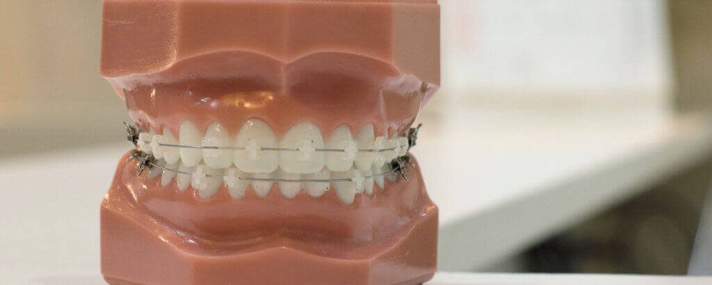 Emergency Wheeler Orthodontics