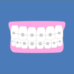 Braces Icon Wheeler Orthodontics