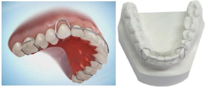 1 Wheeler Orthodontics