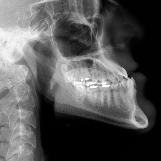 Wheeler Orthodontics, LLC -