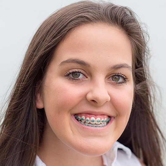 Wheeler Orthodontics, LLC -