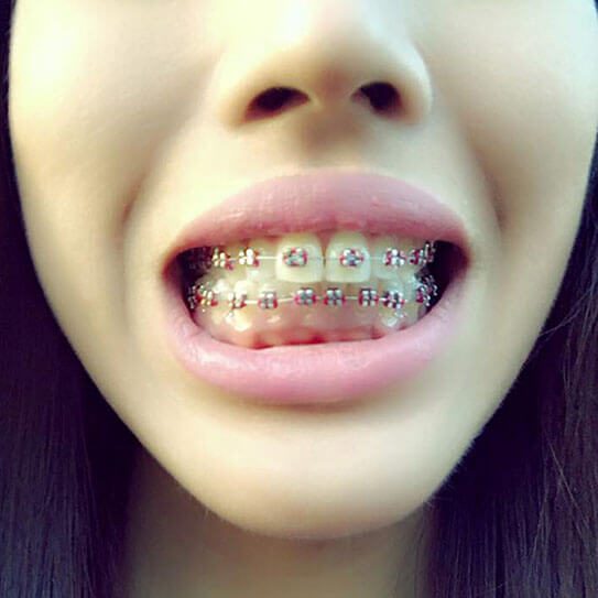 Wheeler Orthodontics, LLC -