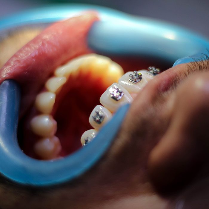 Wheeler Orthodontics, LLC -