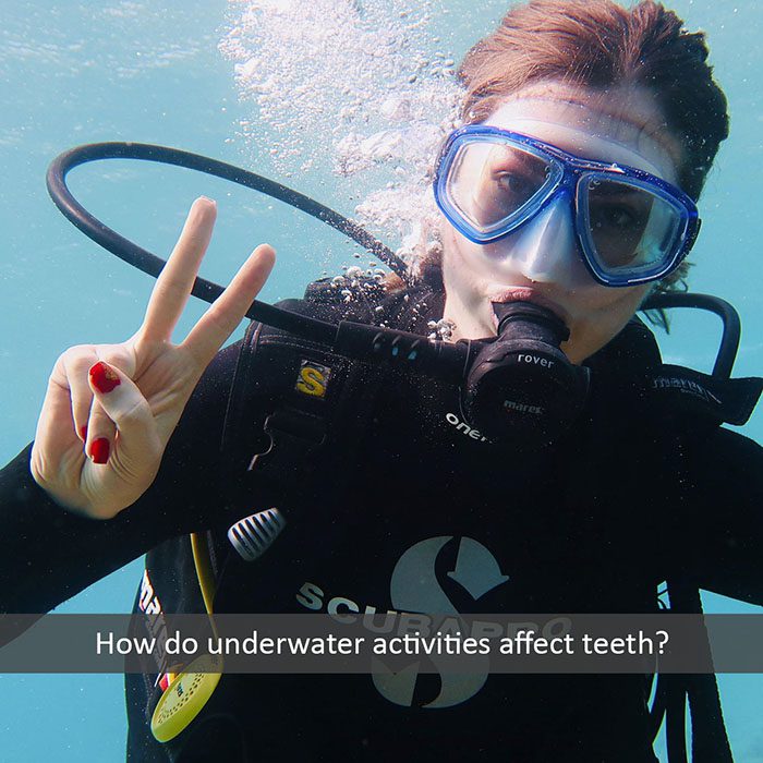 underwater teeth 2022 700 Wheeler Orthodontics