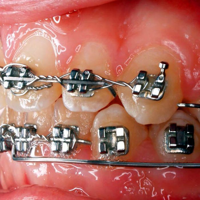 Wheeler Orthodontics, LLC -