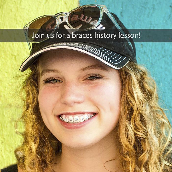 braces history 2022 700 Wheeler Orthodontics