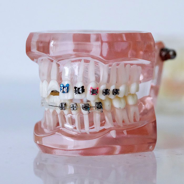 Wheeler Orthodontics, LLC -