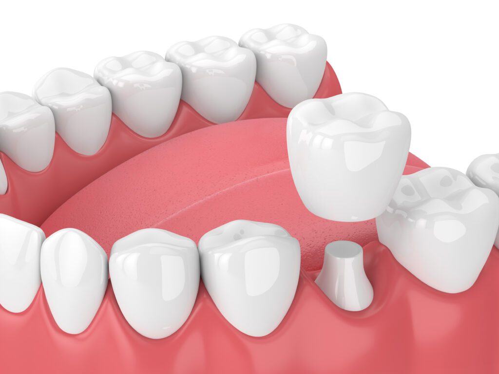 Wheeler Orthodontics, LLC -