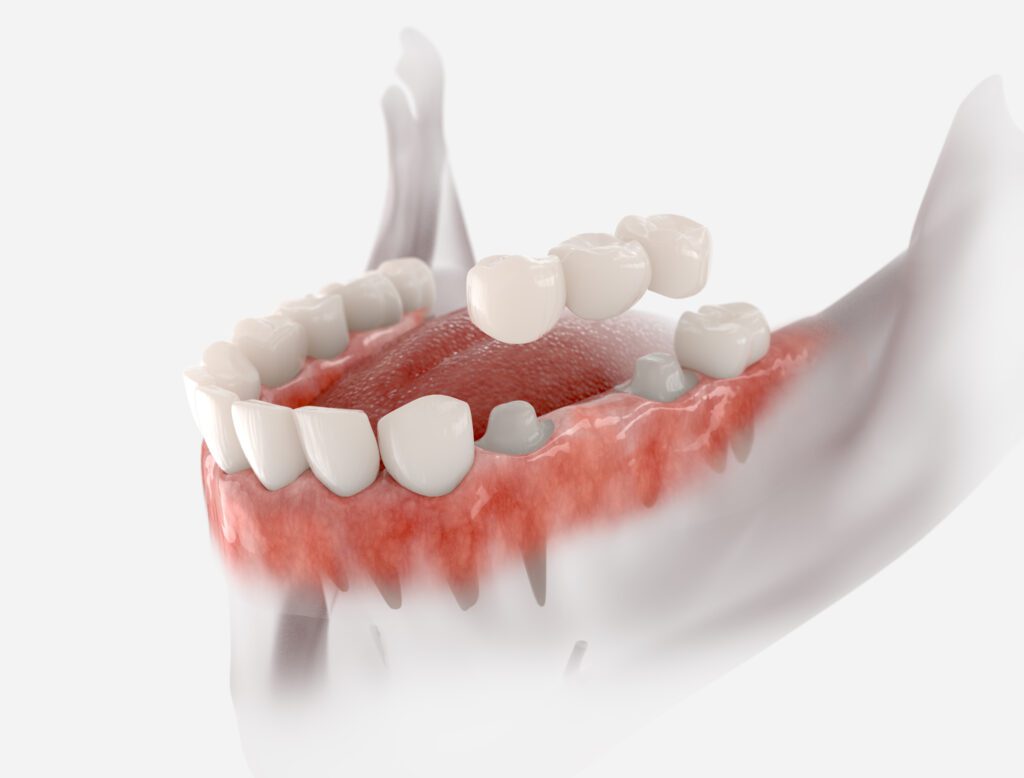 Wheeler Orthodontics, LLC -