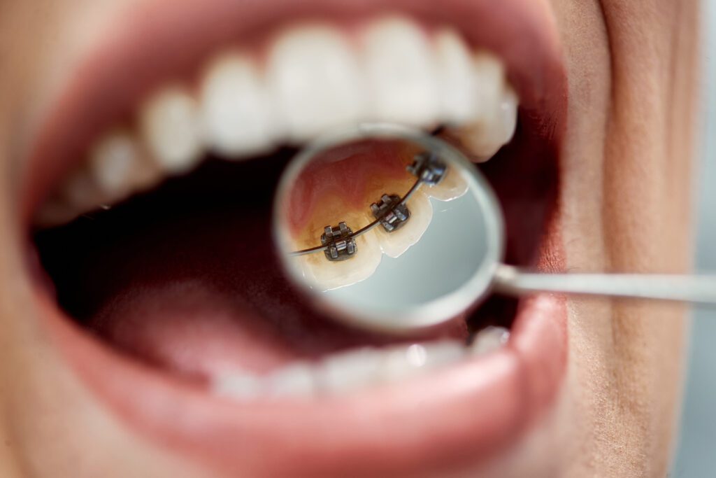 Wheeler Orthodontics, LLC -
