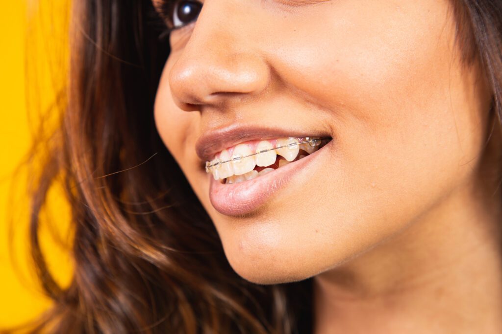 Wheeler Orthodontics, LLC -