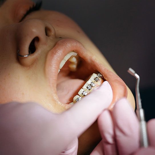orthodontist in Toledo