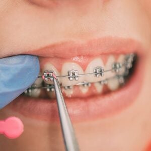 Wheeler Orthodontics, LLC -
