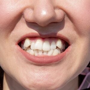 Wheeler Orthodontics, LLC -