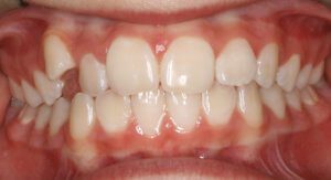 Orthodontist in Toledo, OH