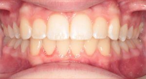 Orthodontist in Toledo, OH