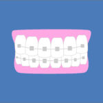 Toldeo Orthodontist