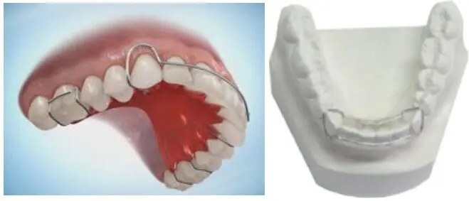 Wheeler Orthodontics, LLC -