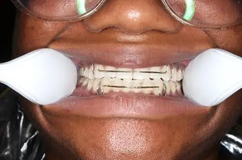 Wheeler Orthodontics, LLC -