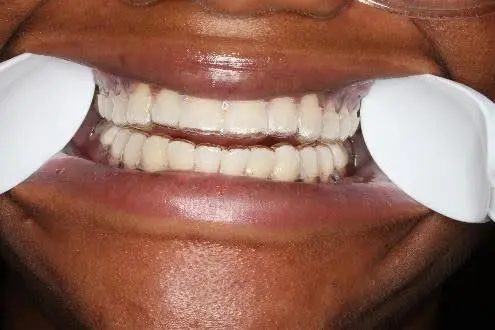 Wheeler Orthodontics, LLC -