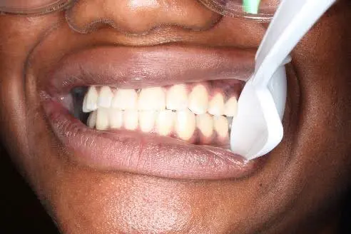Wheeler Orthodontics, LLC -
