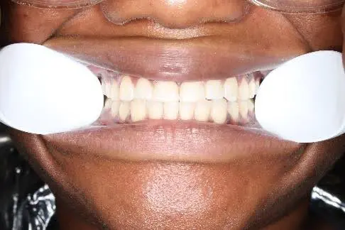 Wheeler Orthodontics, LLC -
