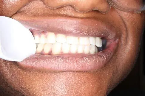 Wheeler Orthodontics, LLC -
